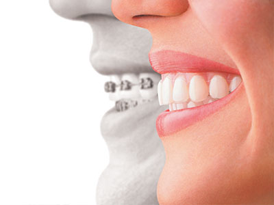 Bethesda Rock Dental | Dental Fillings, Teeth Whitening and Oral Exams